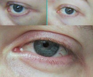 eyes.jpg