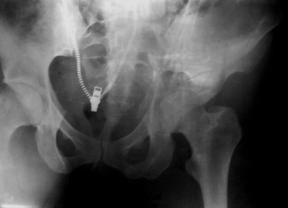 0001_10_09.jpg