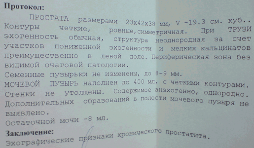 Yzi_6.11.08.png