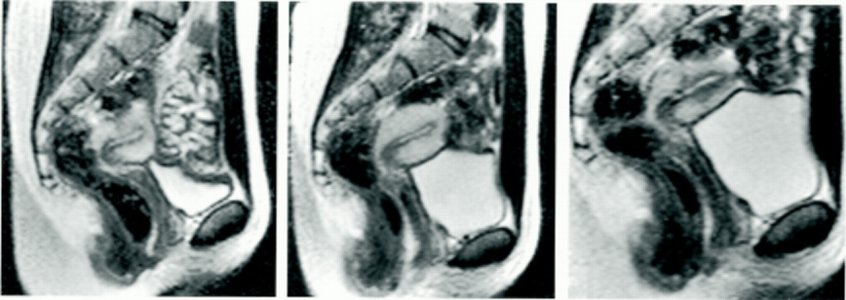 schw4391_f3.jpg