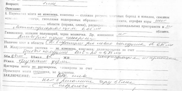 УЗИ мозга 1 мес_resize.jpg