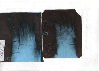 bones.jpg