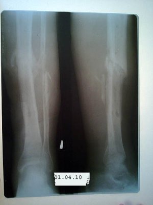 01.04.2010.jpg
