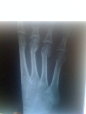 рентген 005_.jpg