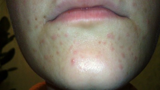 26012011317.JPG