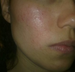 15072011620.jpg