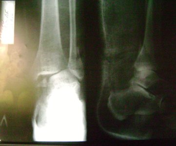 До операции 11.07.2012г..JPG