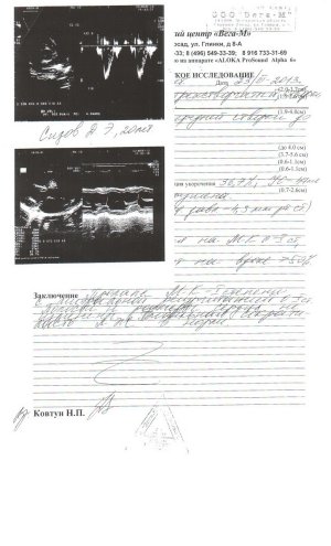 ЭХО КГ22.jpg