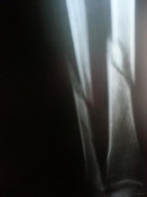 20140429_214356.jpg
