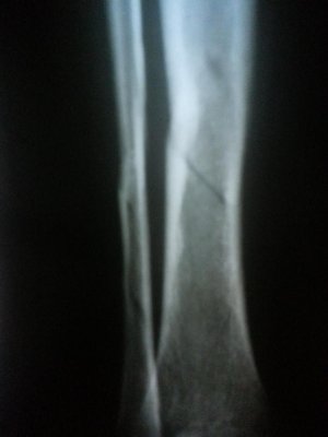 20140429_214417.jpg