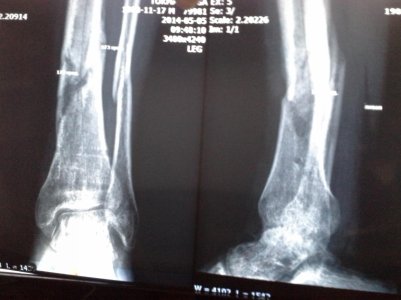 20140505_193843.jpg