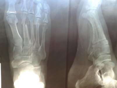 20150703_141434.jpg