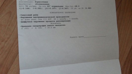 экг.jpg