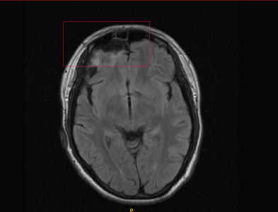 a1aed38285eb.png