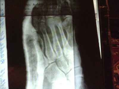 IMG_20161224_170558.jpg