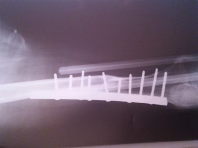 20170122_125038.jpg