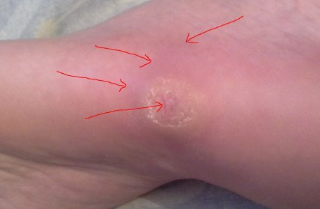 20170327_075228.jpg