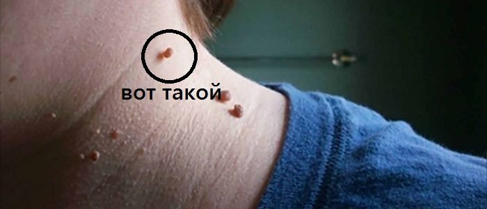 10935767-hiromantiya-chto-znachit-borodavka-na-ladoni.jpg