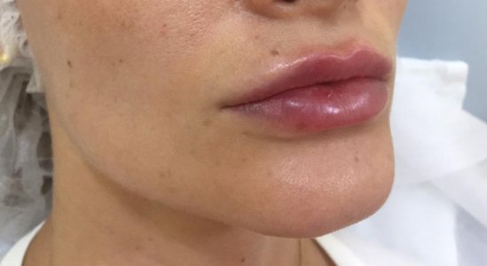 Image2 2019-06-25.jpeg Image2 2019-06-25.jpeg