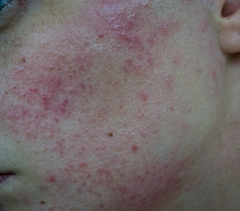 DSC_0004-2.png