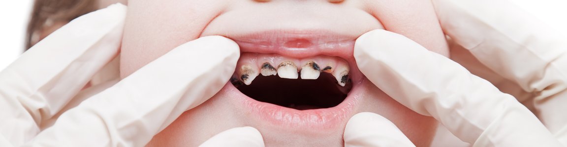 lechenie_periodontita.jpg