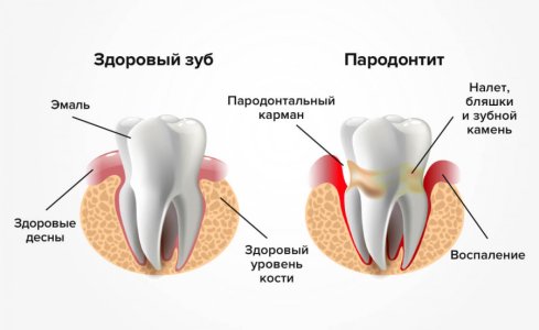 58345f20.jpg