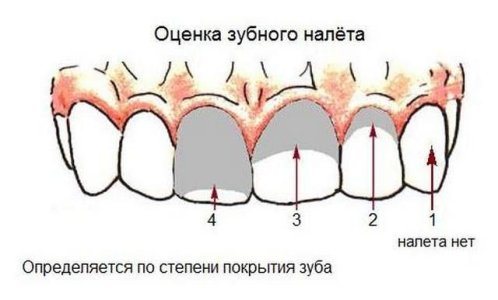 osmotr-zubnogo-naleta.jpg