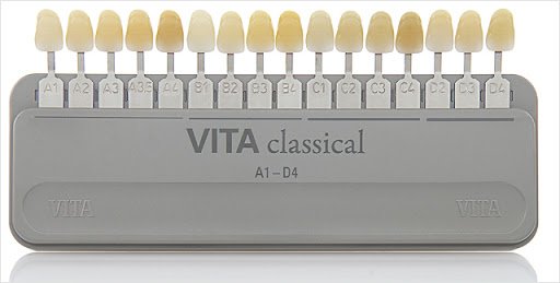 Шкала VITA.jpg
