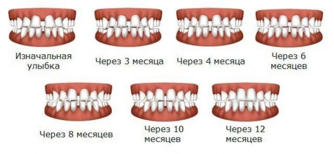 Ортодонтия.jpg