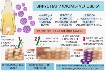 Вирус папилломы человека.jpg