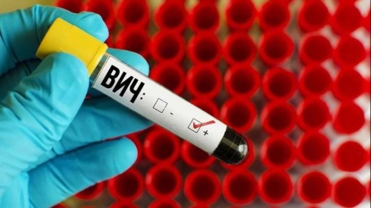 ВИЧ.jpg