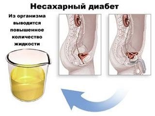 НЕСАХАРНЫЙ ДИАБЕТ.jpg