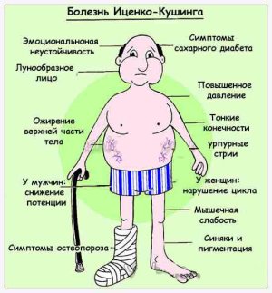 Болезнь и синдром Иценко-Кушинга.jpg