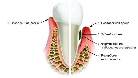 183551-1128x640.jpg.pagespeed.ce.7Wws7Eai-p.jpg