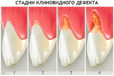 7a07d4a48ec6caa651a8e627008fd322.jpg