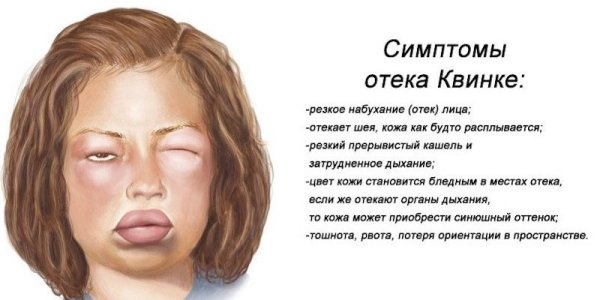 Отек Квинке.jpg