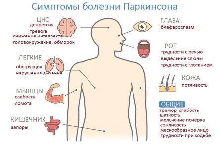 Болезнь Паркинсона.jpg