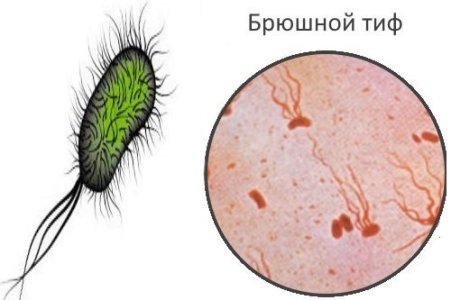 Брюшной тиф.jpg