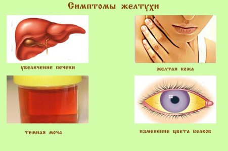 Желтуха.jpg