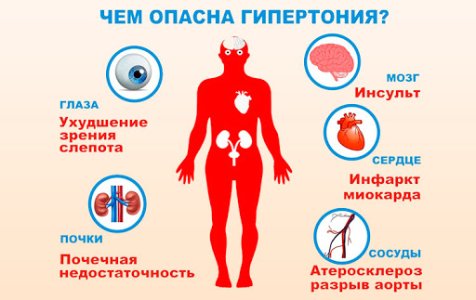 Гипертония.jpg