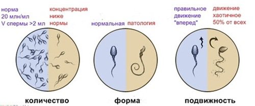 Спермограмма.jpg