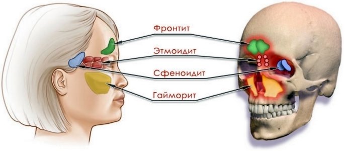 Сфеноидит.jpg