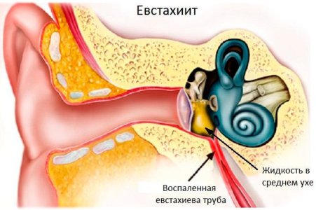Евстахиит.jpg