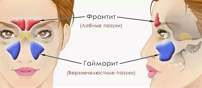 Фронтит.jpg