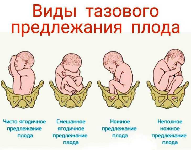 efad86e602a095a6398b337507e75e98.jpg