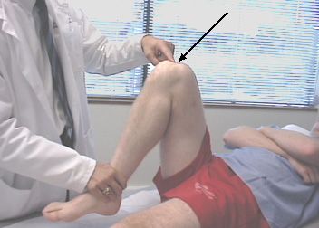 tenderflexionanterior1-1.jpg