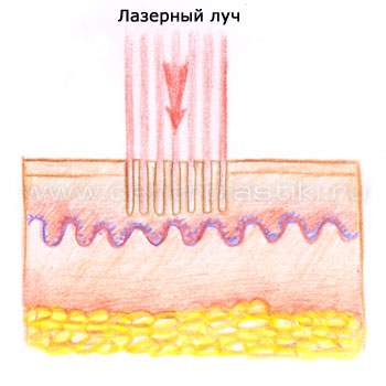 lazer_s0702.jpg